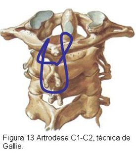 Fig. C1 -Organograma demonstrando a incidência dos diversos